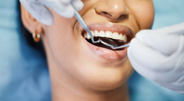 Best Emergency Wisdom Teeth Removal in Webster, SD