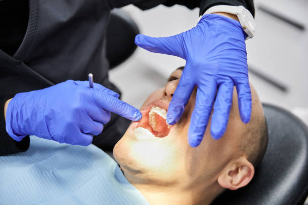 Best Emergency Root Canal Treatment in Webster, SD